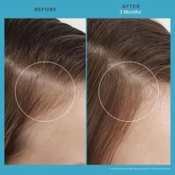 Living Proof Scalp Care Revitalizing Treatment 73ml -Haarverzorgings Winkel scalp care revitalizing treatment 5