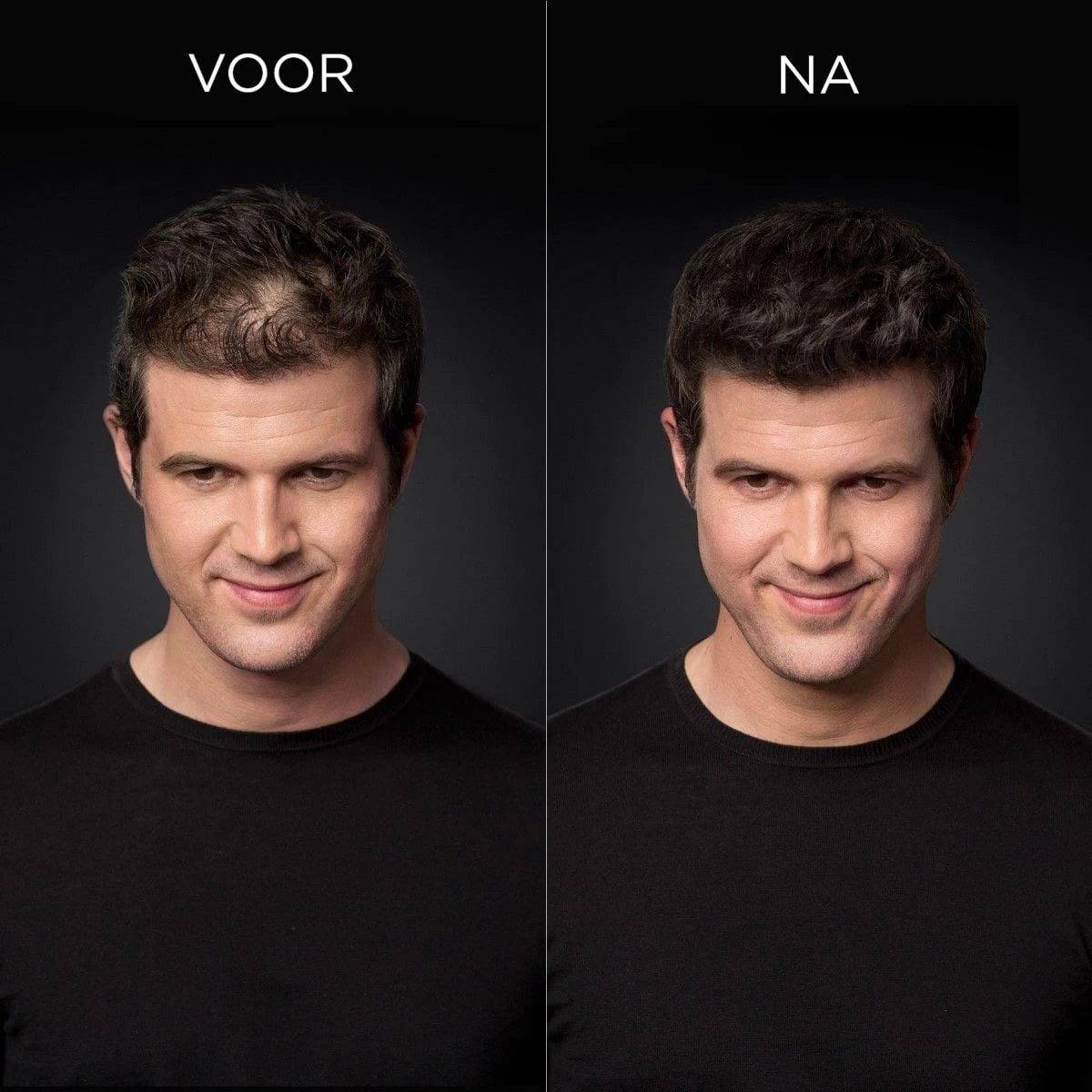 Toppik Colored Thickener Light Brown 144gr 4 Toppik Colored Thickener Light Brown 144gr - Image 2